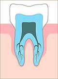 корни зуба